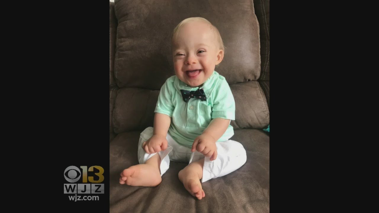 The 2018 Gerber Baby Is The First With Down Syndrome