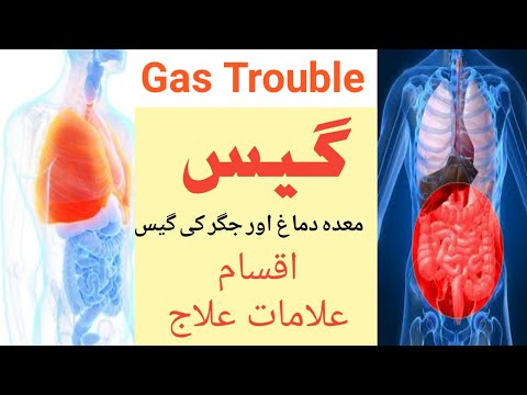 gas trouble گیس کی تین اقسام  علامات اور علاج