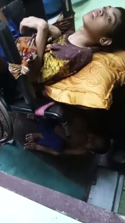 cacat sejak  dari lahir ibunya