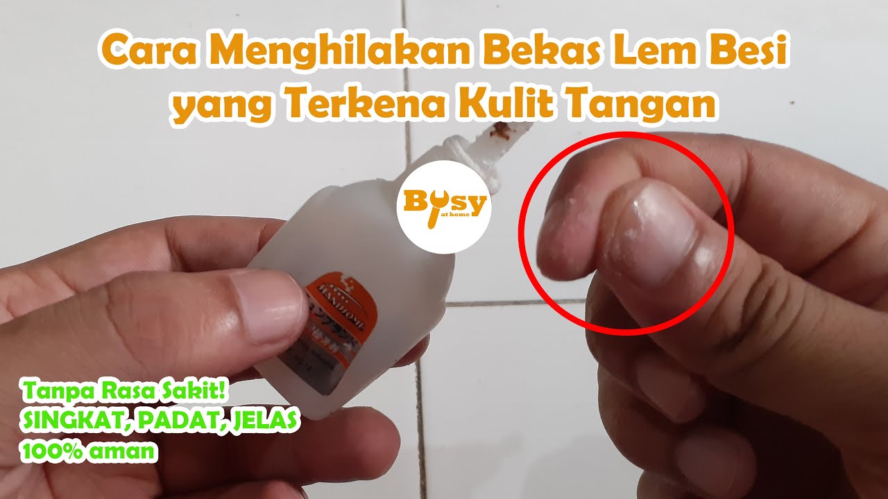 Cara Menghilangkan Bekas Lem Besi pada Kulit Tangan YouTube