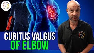 Cubitus Valgus of Elbow (NYC Chiropractor)