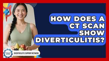 How Does A CT Scan Show Diverticulitis? - Diverticulitis Support Network
