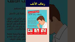 الطريقة الصحيحة لإيقاف رعاف الأنف #نزيف #الأنف #فوائد #صحة #نصائح_طبية