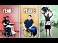 Walking for the first time in 6 years my spinal cord injury recovery story