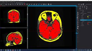 Celebrity Brain extraction Net Worth