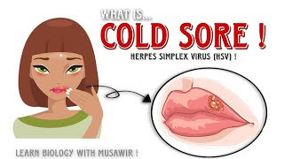 Cold Sores Or Fever Blisters  Small Painful Blisters On Lips  herpes blisters