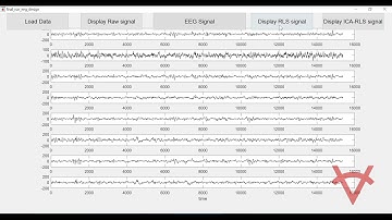 EEG OCULAR ARTIFACTS REMOVAL USING INDEPENDENT COMPONENT ANALYSIS AND ADAPTIVE FILTERING