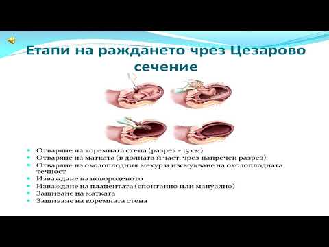 Видео: Неравенство и използване на психичното здраве сред студентите от първи курс в Южна Африка