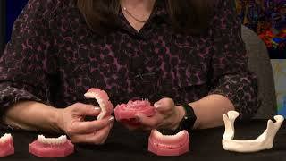 Dr Low 2 minute - Mini Dental Implants