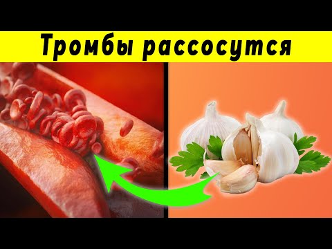 Скажем Нет инсульту и инфаркту | Как разжижить густую кровь без лекарств