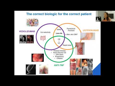 Huisartsen en gastro-enterologen: hoe kunnen we elkaar helpen? (Webinar - 8 december 2020)