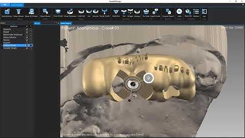 Implant 3D Software - Surgical guide in 15 minutes