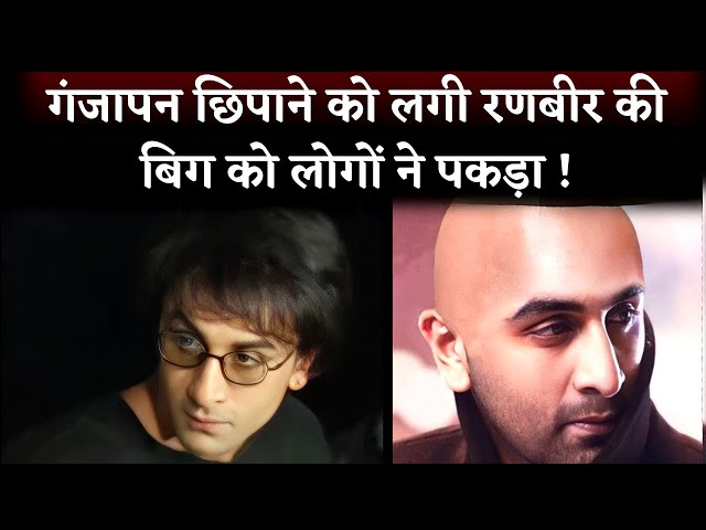 SHOCKING! Ranbir Kapoor Is Using A Wig Cause Of Balding? 