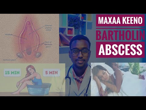 Maxaa keeno Bartholin Abscess|Si Fudud Ku Ogow| Dr Sadam Hussein