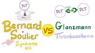 Bernard Soulier Syndrome (BSS) vs Glanzmann Thrombasthenia (GT)