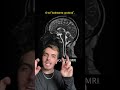 Nosso cérebro pulsa assim como o Coração #shortsvideo #shorts #ciencia #ciência #neurociencia