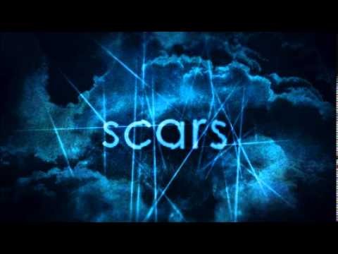 Why Did Paul Have Scars? (Galatians 6:17) James Flanders - YouTube