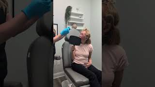 3 Days after CURRENT Lift, Upper Bleph and Laser