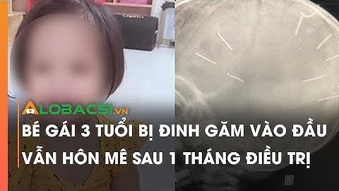 Bé gái 3 tuổi bị đinh găm vào đầu vẫn hôn mê sau 1 tháng điều trị