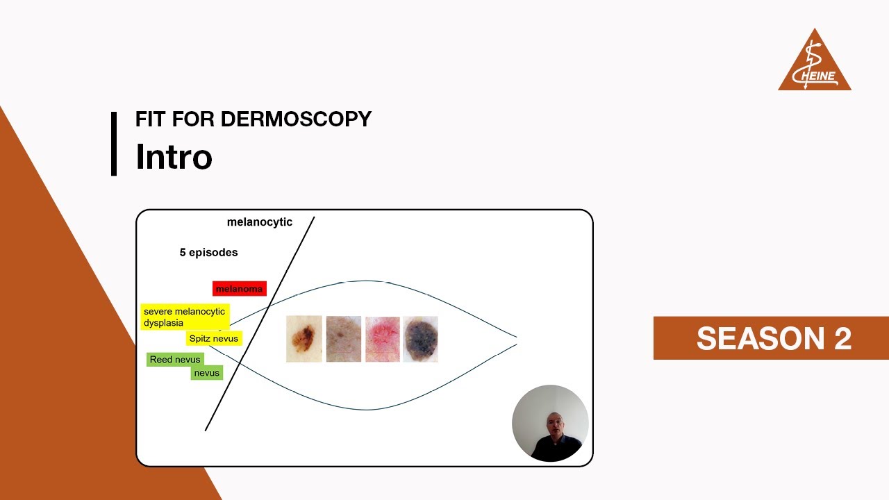 Fit for Dermoscopy Intro Series 2 - Melanocytic lesions