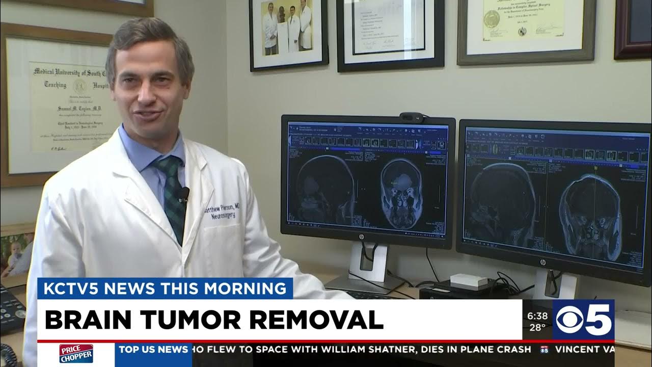 Man gets second chance at life after brain tumor removal Dr. Pierson