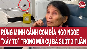 Rùng mình cảnh con đỉa ngo ngoe “xây tổ” trong mũi cụ bà suốt 3 tuần