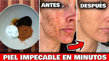 ¿Qué alimentos eliminan las manchas oscuras de la cara?