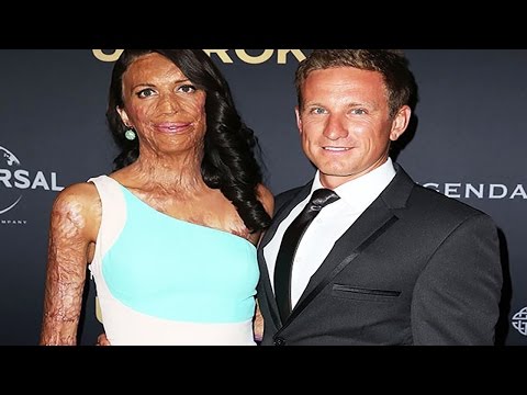 Video: Turia Pitt On Jo äiti