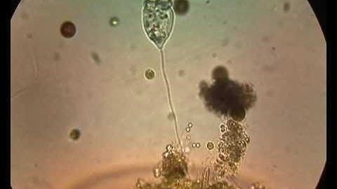 Vorticella