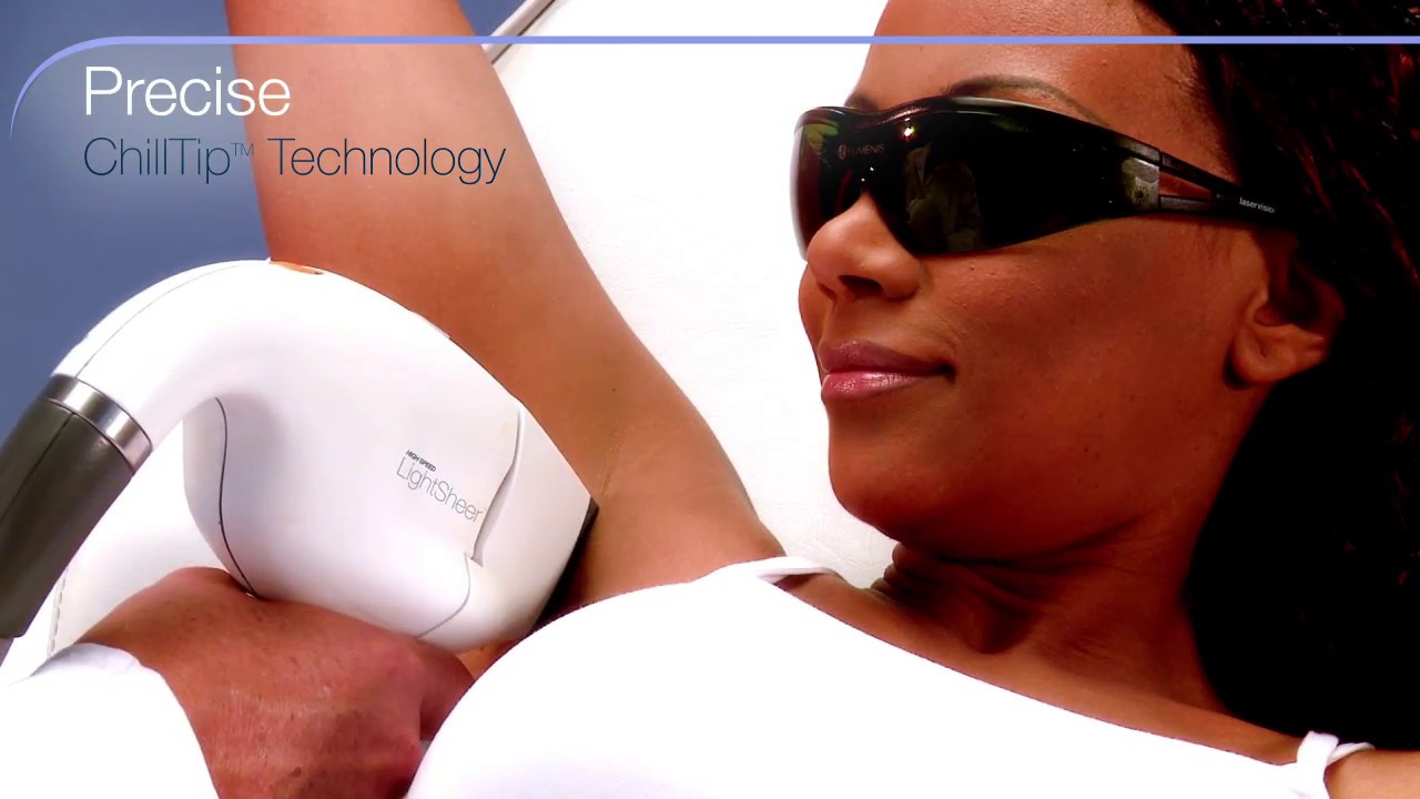 Lumenis LightSheer INFINITY - Product Video