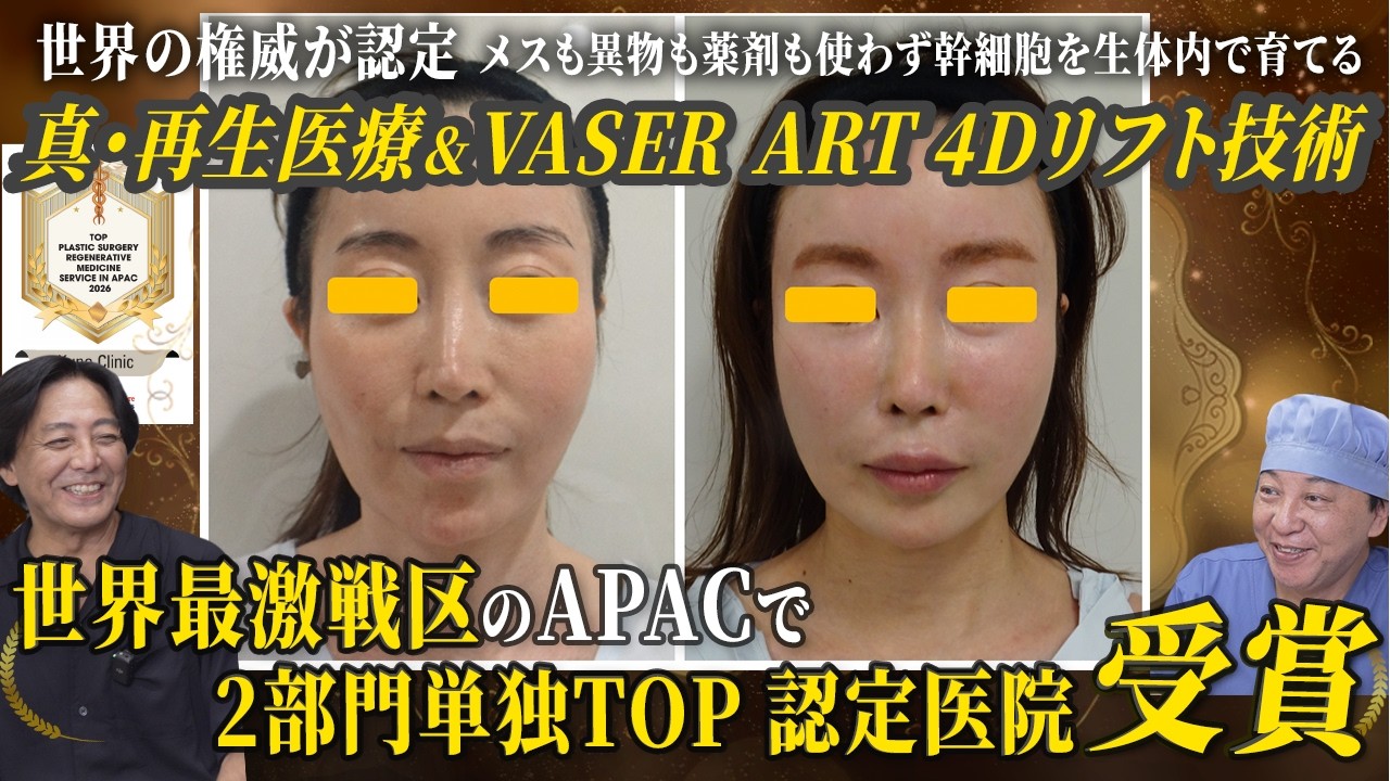 時を超える4Dハイブリッド再生医療＆脂肪吸引」エイジングケア施術
