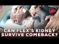 Can flex wheelers kidney handle cutting water weight  flex on em