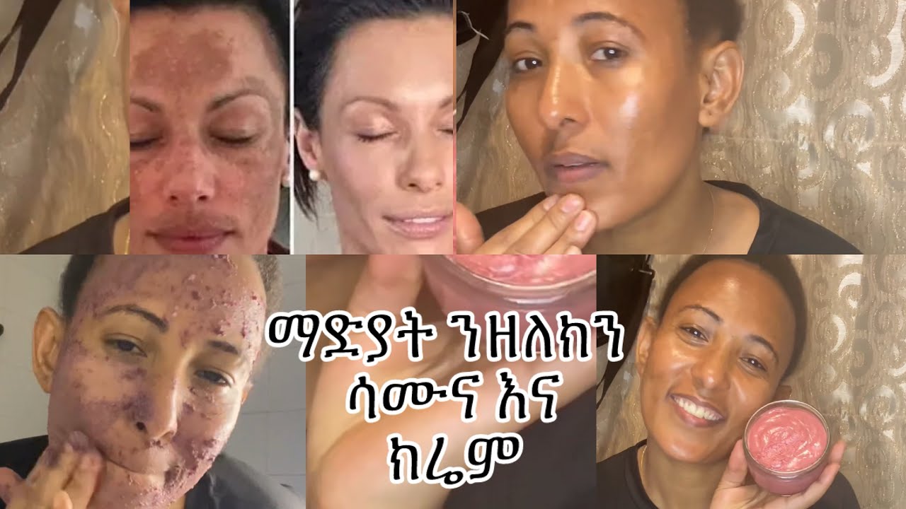ማድያት ዘጥፍኡልና ሳሙና እና ክሬም(hand made soap and cream facial treatment 🥰)#skincare #tigray #ethiopian