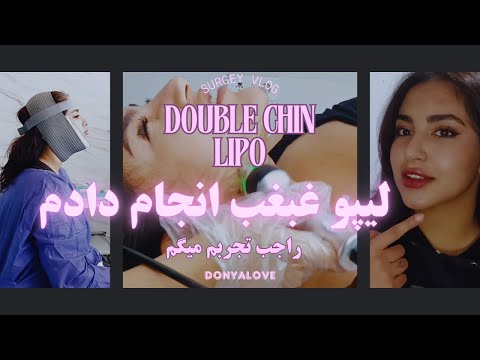    ولاگ تجربه من از لیپو غبغب