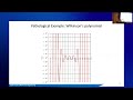MFEM Workshop 2025 | Quadrature Procedures for 4D Applications and Beyond