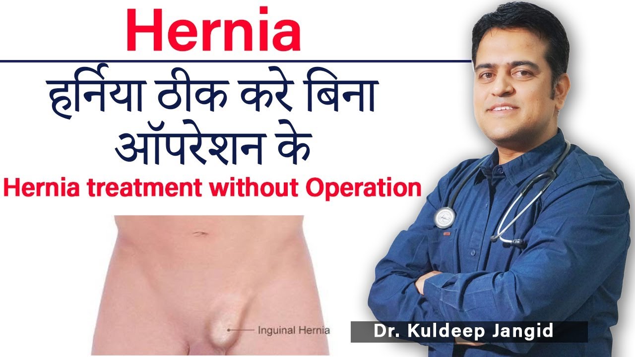 Types Of Hernia Epigastric Lateral Umbilical Inguinal Femoral
