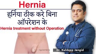 Hernia Treatment without Operation | हर्निया ठीक करें बिना ऑपरेशन के | Best Treatment of Hernia