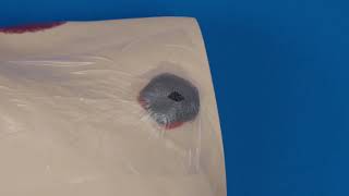 Dressing Smaller Wounds Than The FitPad I Tips and Tricks I NPWT
