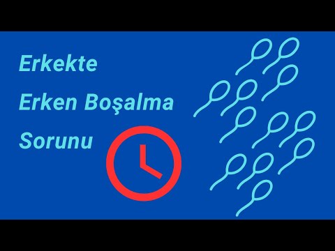 Video: Dulles'a ne kadar erken varmanız gerekiyor?