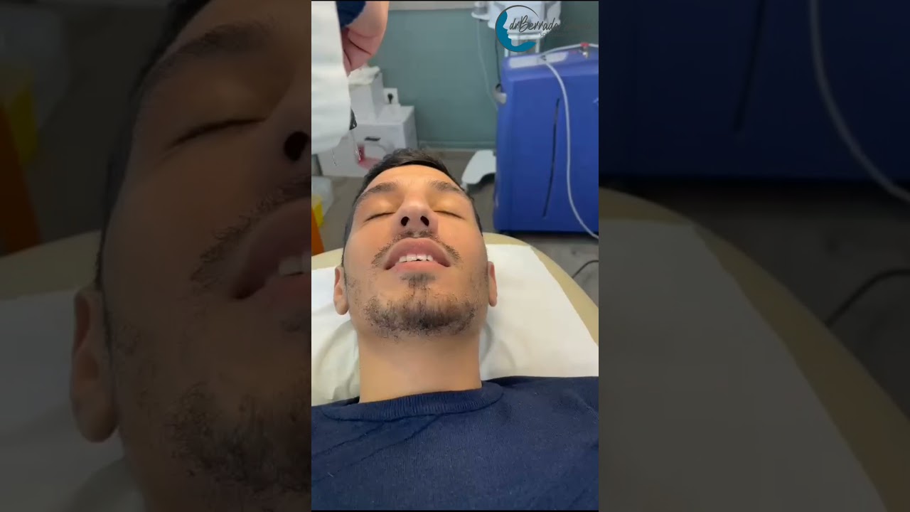 Laser CO2 Smartxide Punto traitement de cicatrices. Témoignage du patient