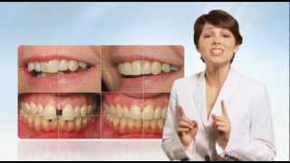 Six Month Smiles® in Salinas, CA