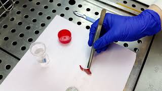 Anatomopathologie L examen extemporane