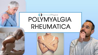 Polymyalgia Rheumatica | Signs and Symptoms of PMR