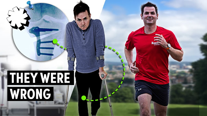 How I Ran Again, After Being Told I Never Would
