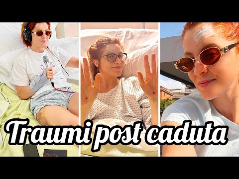 Video Noemi mostra i traumi post caduta dal palco: 1 mese di riposo concerti annullati