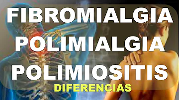 ¿Cuál es la diferencia entre fibromialgia y polimialgia?