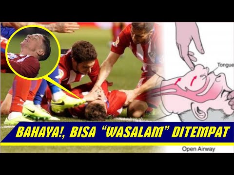 Bahaya Lidah Tertelan dan Cara Memberikan Pertolongannya dalam