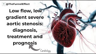 Low flow, low gradient severe aortic stenosis: diagnosis, treatment and prognosis