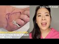 Prevent Dangerous Toe Infections &amp; Cellulitis: Quick Fixes &amp; Why Moisture Matters! | Miss Foot Fixer