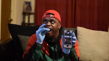 Unboxing Byte Invisible Aligners Kit !!!! 02/2019